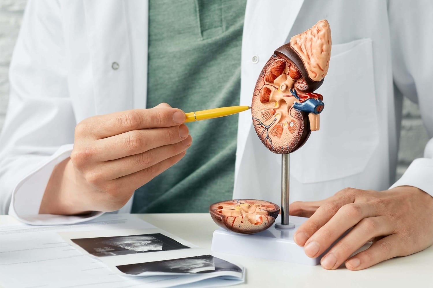 Kidney stone treatment in Mumbai
